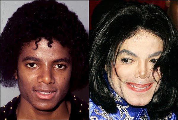 Michael-Jackson-Plastic-Surgery-Before-A